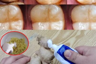 How to naturally repair a cavity. Keep these tips in mind to avoid visiting the dentist