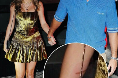 Hours ago: Fans worried after discovering Taylor Swift’s obvious burn in photo with Travis Kelce.What happened to her?/hi
