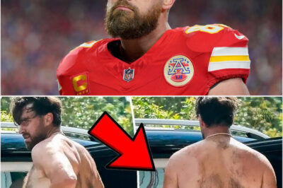 DON’T MISS: New Offseason Photos of Travis Kelce That Will Make You Unbelievable. He’s Really Changed Incredibly/hi