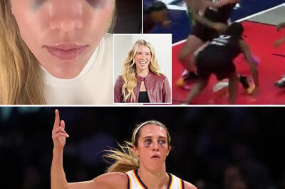 Caitlin Clark’s Indiana Fever teammate Lexie Hull reveals two ‘insane’ black eyes after brutal collision with rival /hi